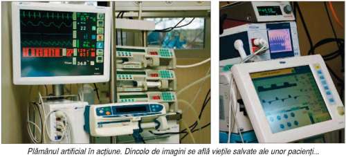 Problemele respiratorii, rezolvate de plămânul artificial din Timişoara Problemele respiratorii, rezolvate de plămânul artificial din Timişoara