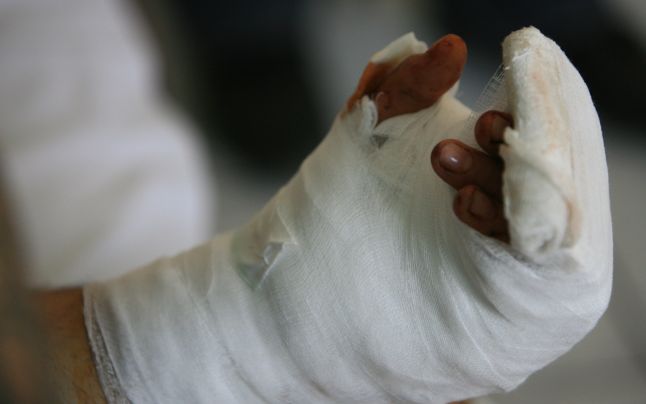 A ajuns la spital după ce şi-a prins mâna în tocătorul de coceni A ajuns la spital după ce şi-a prins mâna în tocătorul de coceni
