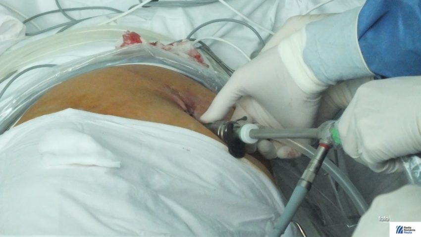 Doi medici, o asistentă şi un pacient au fost electrocutaţi în sala de operaţii! Doi medici, o asistentă şi un pacient au fost electrocutaţi în sala de operaţii!