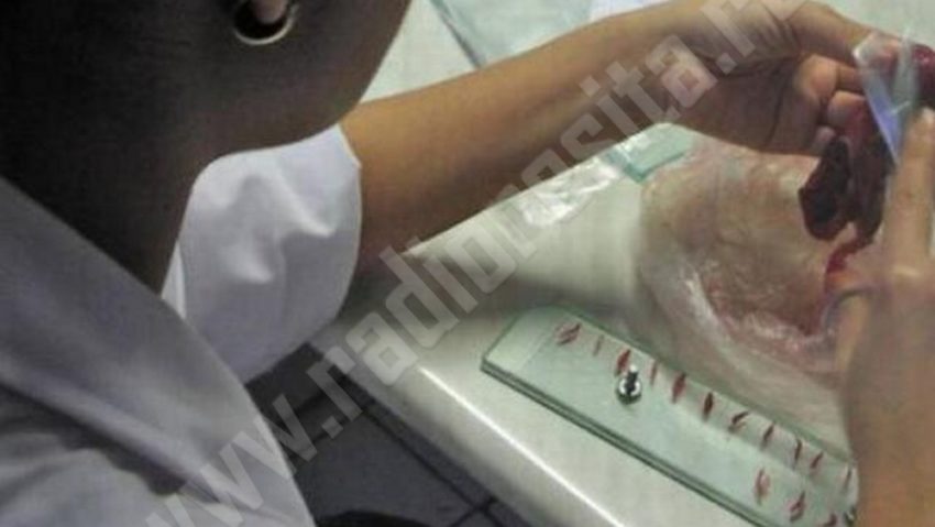 Avertizare DSVSA: Efectuarea examenului trichineloscopic este obligatorie!