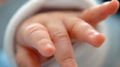 Un copil s-a născut fără faţă. Caz extrem de rar