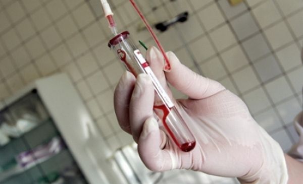 Omagiu pentru persoanele care au decedat în urma SIDA. ,,Ziua lumânărilor aprinse’’ la Timișoara Omagiu pentru persoanele care au decedat în urma SIDA. ,,Ziua lumânărilor aprinse’’ la Timișoara