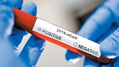DSP: 76 de persoane pozitive și 3 decese din cauza virusului SARS CoV-2 în Caraș-Severin