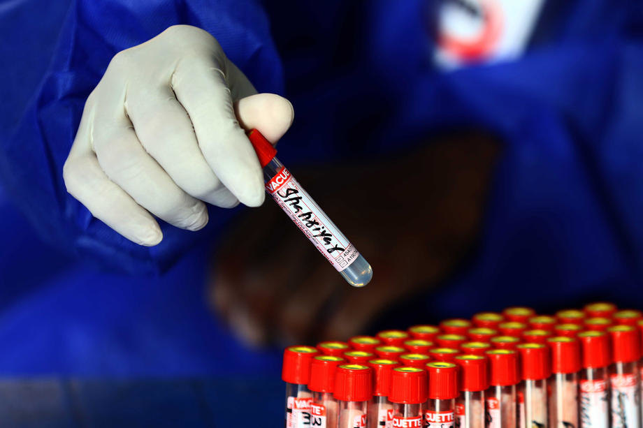 Coronavirus pandemic in Pakistan
