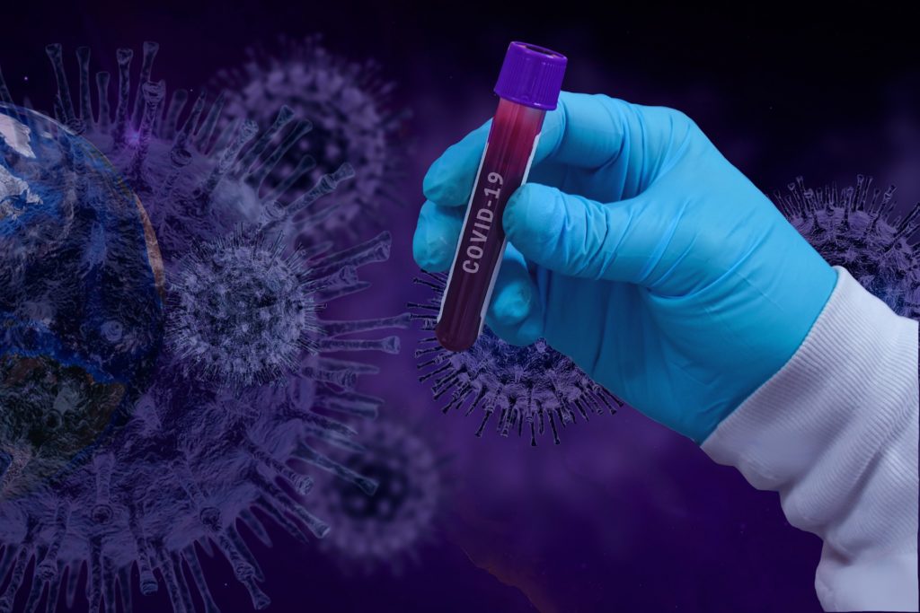 GCS: 69 cazuri noi de persoane infectate cu SARS – CoV – 2 şi 30 de decese în ultimele 24 de ore, în România - Vimarsana News