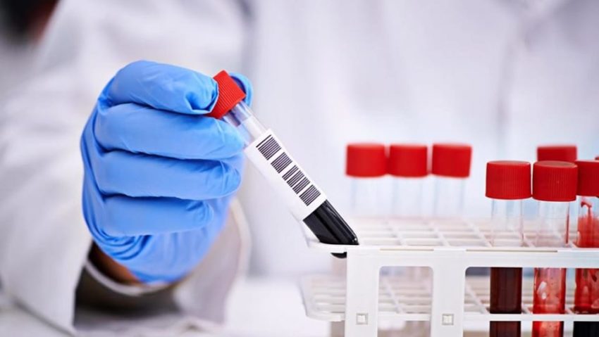 Octombrie este luna analizelor gratuite la Spitalul de Boli Infecțioase„Dr. Victor Babeș” Timișoara