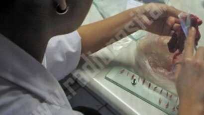 În Caraş-Severin trichineloza rămâne o amenințare: veterinarii cer responsabilitate în achiziția porcilor pentru sacrificare